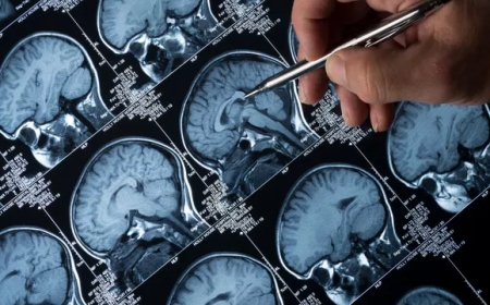 Российские ученые предложили новый подход к борьбе с болезнью Альцгеймера