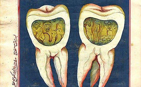 Иллюстрация из Османского медицинского манускрипта. Джинны, сидящие в зубах. Так представляется кариес. XVIII век