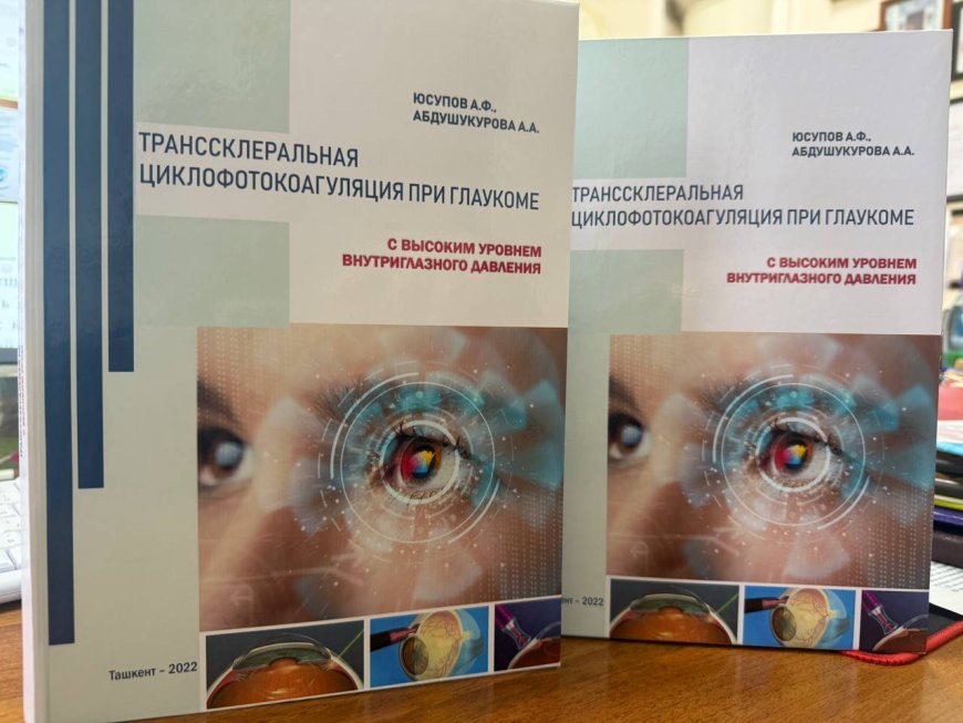 Юсупов Ф. Ф., Абдушукурова А. А. Транссклеральная циклофотокоагуляция при глаукоме с высоким уровнем внутриглазного давления: Монография