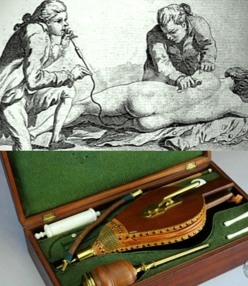 В XVII веке была распространена весьма странная процедура – клизма с табачным дымом